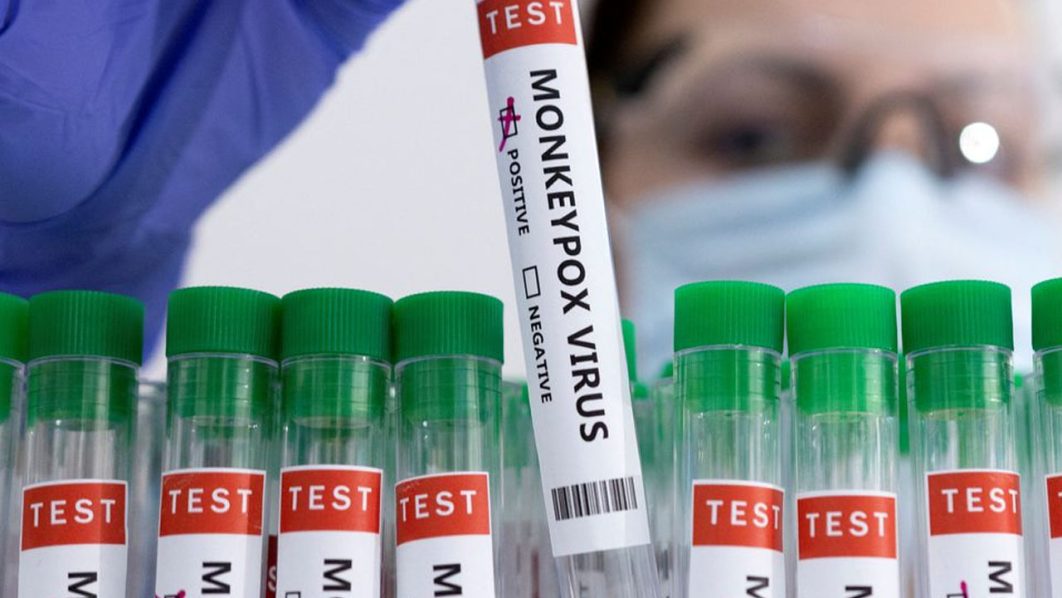 Test tubes labelled “Monkeypox virus positive” are seen in this illustration taken May 23, 2022. REUTERS/Dado Ruvic/Illustration