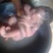Fire service rescues newborn dumped in pit toilet