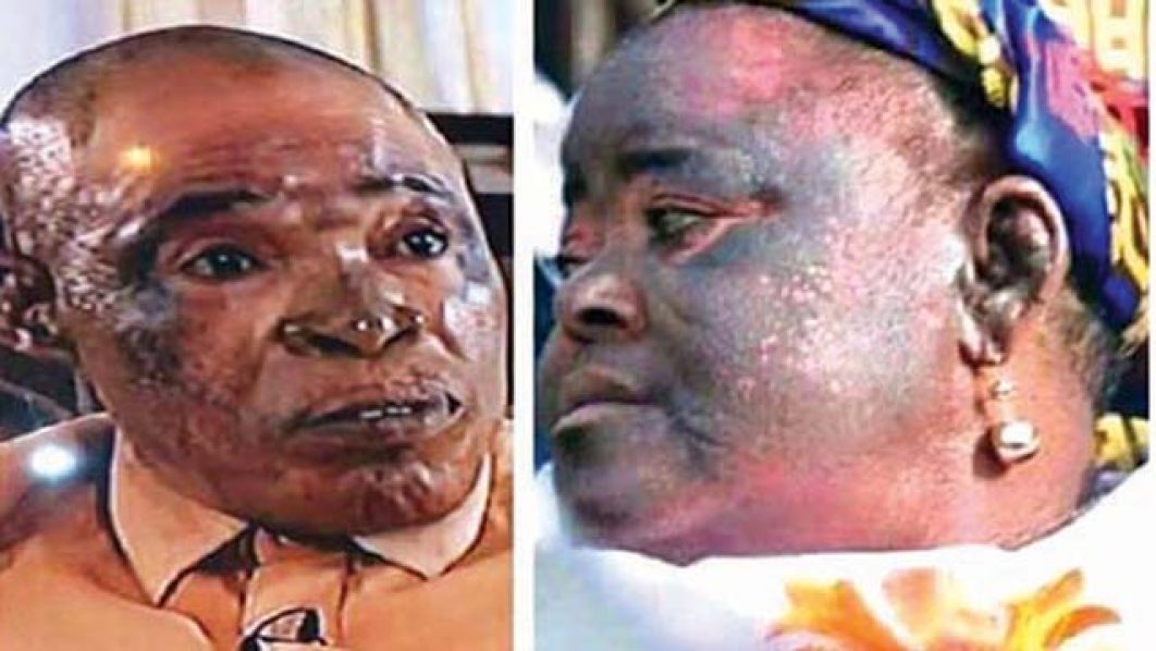 Expert warns Nigerians against bleaching 1 Expert warns Nigerians against bleaching