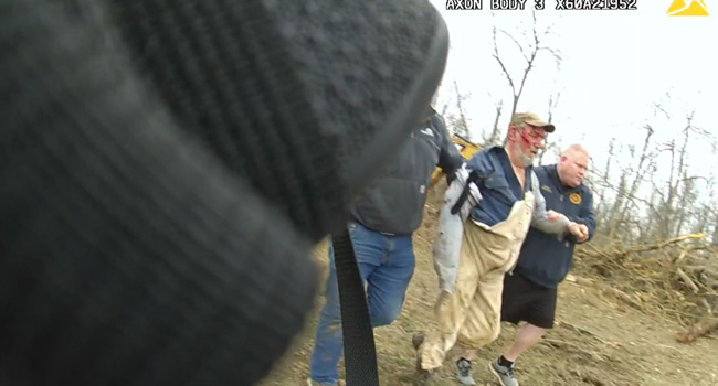 Zebra Shot Dead After Biting Man In US Attack 1 Zebra Shot Dead After Biting Man In US Attack