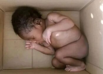 Recovered baby 1030x580 1 Farmer discovers newborn baby dumped in Jigawa Nigeria farm